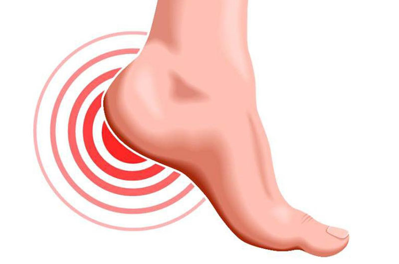 Tiếp đất sai sau những pha bật nhảy sẽ dễ chấn thương phần gót